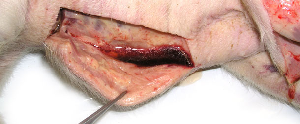Gonflement du tissu sous-cutané, une grande quantité de fluide s'écoule après une incision de la peau dans la zone basse du corps. 