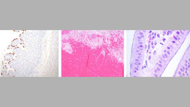 Rotavirus, E.coli et Clostridium perfringens