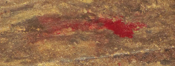 Féces aqueuses avec contenu sanglant