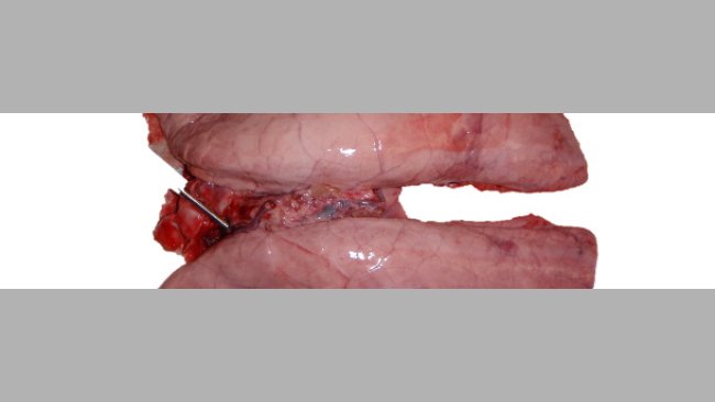Poumon infecté expérimeentalement avec Mycoplasma hyopneumoniae.