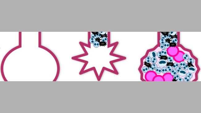 Pathogénie du virus de l'Influenza porcine