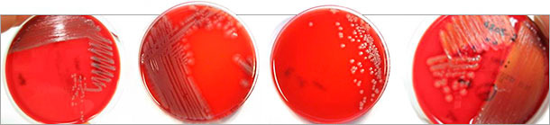 Différentes morphologies coloniales d’isolats d’E. coli pathogènes 