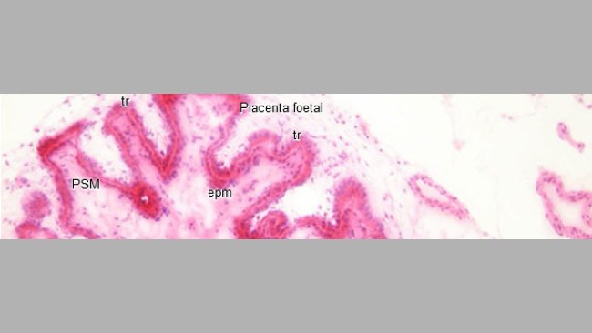Histopathologie de l’endomètre et du placenta