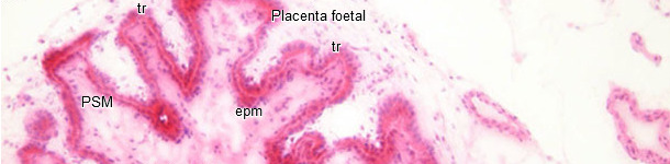 Histopathologie de l’endomètre et du placenta