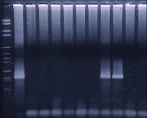 PCR fluorogénique pour détecter le SDRPv.
