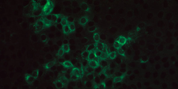 Fotomicroscopía de inmunofluorescencia positiva en una monocapa MARC145 infectada por PRRSV, incubada con un suero de cerdo que contiene anticuerpos IgG específicos para PRRSV y teñida con anticuerpos IgG anti-porcinos de cabra conjugados con FITC
