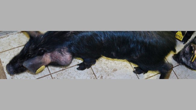 Mélanome et métastase dans les ganglions