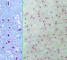 Coloration de Maneval de la souche virulente Nagasaki, montrant la capsule comme un halo blanc autour de la bactérie. La capsule pourrait être responsable de la résistance au sérum et à la phagocytose