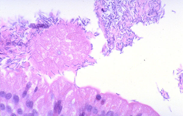 intestin grêle d’un porcelet avec de la diarrhée associée à l’infection par Clostridium perfringens de type A