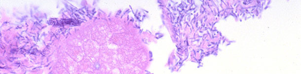 intestin gr&ecirc;le d&rsquo;un porcelet avec de la diarrh&eacute;e associ&eacute;e &agrave; l&rsquo;infection par Clostridium perfringens de type A