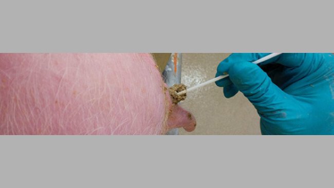 Ecouvillonnages rectaux