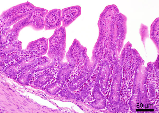 Section histologique de l’intestin grêle. On a localisé plusieurs granulocytes éosinophiles dans la muqueuse.