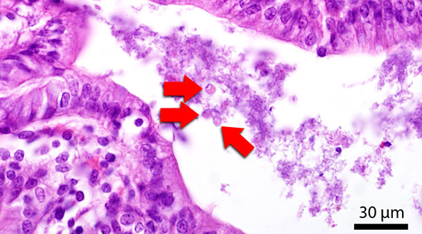 Section histologique du côlon. Les flèches rouges montrent Blastocystis dans la lumière intestinale..