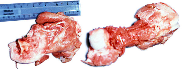 Tête du fémur facturée sur un des porcs atteints (gauche) et fémur normal (droite).