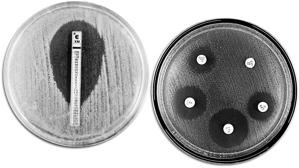 <p>Techniques classiques d'évaluation de la résistance aux antibiotiques. A gauche on voit un E-TEST qui permet de mesurer la concentration minimum d'antibiotique qui empêche la croissance bactérienne. A droite on voit un antibiogramme où on observe différentes zones d'inhibition de la croissance dues aux antibiotiques.</p>