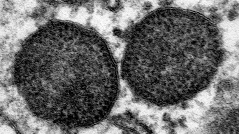 Microphotographie &eacute;l&eacute;ctronique de deux corps d&#39;inclusion dans le cytoplasme d&#39;un macrophage qui incluent&nbsp;un nombre tr&egrave;s &eacute;lev&eacute; de particules de PCV2. 150.000x. Source: Carolina Rodr&iacute;guez-Cari&ntilde;o, CReSA
