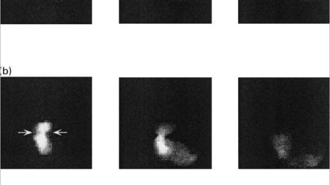 Figure 1. Images de la vidange gastrique chez les porcs nourris avec un régime à base d'amidon (a), de pulpe de betterave (b) et de son de blé 10, 60 et 120 minutes après l'ingestion (Source: Guerin et al., 2001) ).
