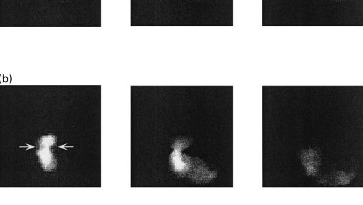 Figure 1. Images de la vidange gastrique chez les porcs nourris avec un r&eacute;gime &agrave; base d&#39;amidon (a), de pulpe de betterave (b) et de son de bl&eacute; 10, 60 et 120 minutes apr&egrave;s l&#39;ingestion (Source: Guerin et al., 2001) ).
