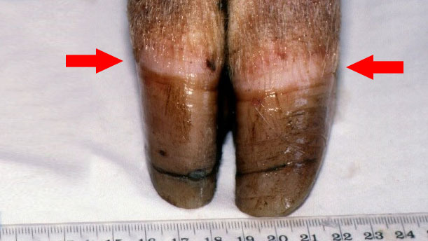 <p>Figure 1. Bande coronaire [fl&egrave;che]. Notez la croissance in&eacute;gale et la fissuration du sabot.</p>
