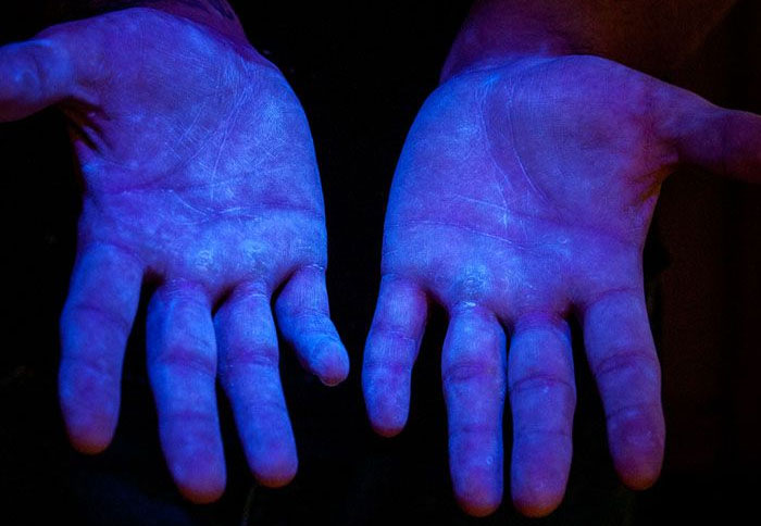 Photo 6. Mati&egrave;re fluorescente sous ultraviolets (UV) pour d&eacute;montrer que le produit couvre toutes les mains. Source www.glogerm.com
