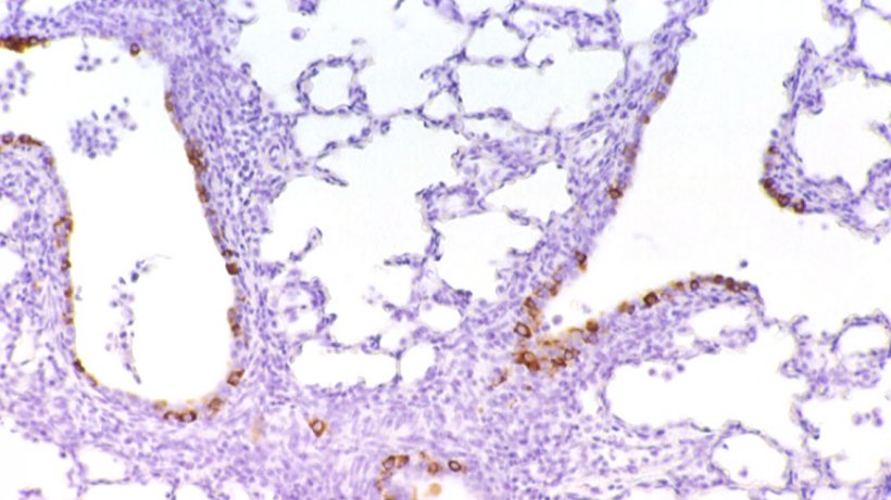Figure 6: Cellules immunocolor&eacute;es contre le PRCV dans l&#39;&eacute;pith&eacute;lium bronchiolaire.
