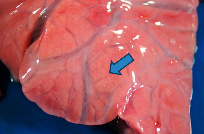 Figure 4 : Bronchopneumonie purulente : &eacute;largissement de la consolidation cranioventrale o&ugrave; de petites zones jaune-blanc (fl&egrave;che) sont observ&eacute;es, correspondant aux alv&eacute;oles pulmonaires remplies de mat&eacute;riel purulent. Un &oelig;d&egrave;me interstitiel est &eacute;galement observ&eacute;.
