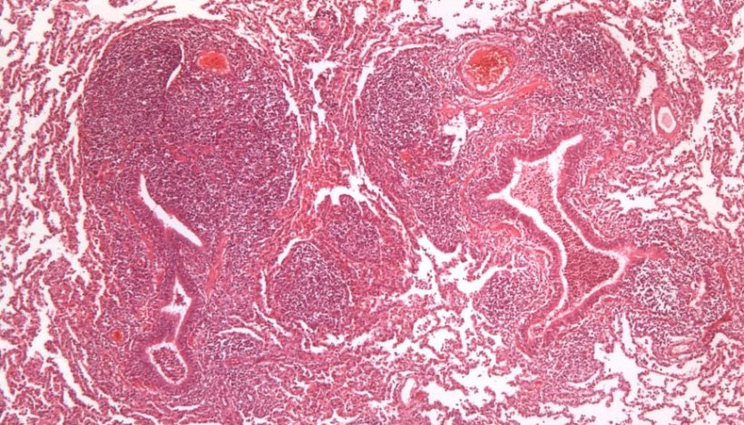 Figure 2 : Hyperplasie du tissu lympho&iuml;de p&eacute;ribronchiolaire caus&eacute;e par M. hyopneumoniae.
