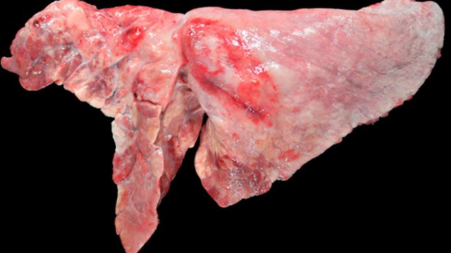 Figure 5.&nbsp;Poumon d&#39;un porc co-infect&eacute; par M. hyopneumoniae et A. pleuropneumoniae. Zones brun rouge&acirc;tre de consolidation cranioventrale, caus&eacute;es par une infection par M. hyopneumoniae, et une l&eacute;sion ovale avec fibrose pleurale et zones h&eacute;morragiques dans le lobe diaphragmatique, qui correspondrait &agrave; la chronicit&eacute; d&#39;un foyer de n&eacute;crose produit par A. pleuropneumoniae.
