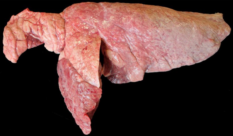 Figure 6. Poumon d&#39;un porc co-infect&eacute; par M. hyopneumoniae et P. multocida. Zones brun rouge&acirc;tre de consolidation cranioventrales sur&eacute;lev&eacute;es par rapport au reste du parenchyme pulmonaire qui correspondraient &agrave; une l&eacute;sion par P. multocida. Dans le lobe cr&acirc;nial et le bord cranioventral du lobe caudal, des zones de consolidation rouge&acirc;tres et d&#39;aspect d&eacute;prim&eacute; sont observ&eacute;es, correspondant aux l&eacute;sions caus&eacute;es par M. hyopneumoniae.
