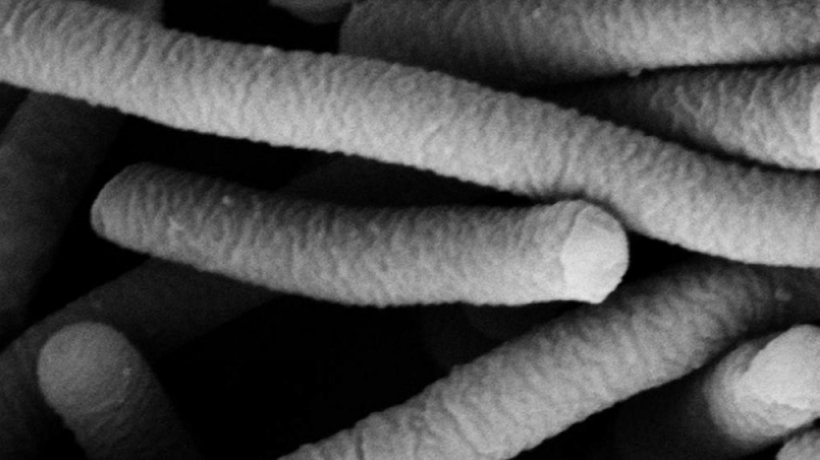 Photo 1. Microscopie &eacute;lectronique de Lactobacillus acidophilus, qui poss&egrave;de des caract&eacute;ristiques probiotiques. Photo de Mogana Das Murtey et Patchamuthu Ramasamy.
