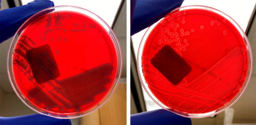 E. coli non h&eacute;molytique (gauche) et&nbsp;E. coli h&eacute;molytique (droite)
