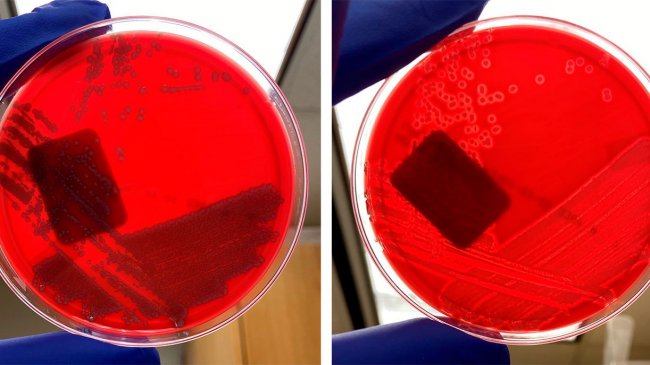 E. coli non h&eacute;molytique (gauche) et&nbsp;E. coli h&eacute;molytique (droite)
