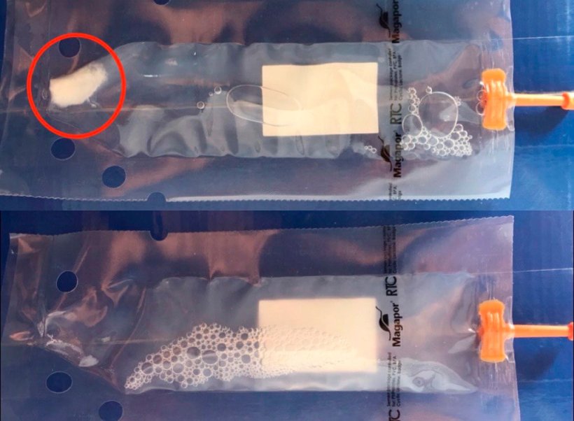 Photo 2. Dans la partie sup&eacute;rieure de l&#39;image, dose avec s&eacute;dimentation s&eacute;minale, dans la partie inf&eacute;rieure, dose correctement homog&eacute;n&eacute;is&eacute;e. Cette homog&eacute;n&eacute;isation &eacute;vitera la perte de viabilit&eacute; des spermatozo&iuml;des et la meilleure r&eacute;partition de ceux-ci dans le milieu.
