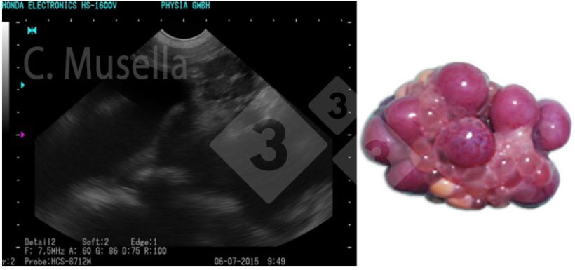 Figure 1. Corps jaune.