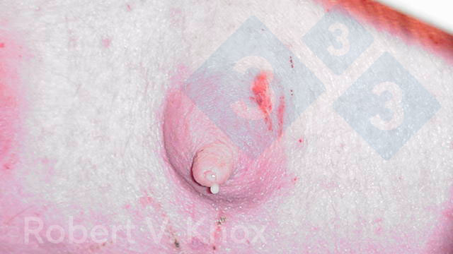 <p>Image 2. Colostrum s'&eacute;coulant de la glande mammaire.</p>
