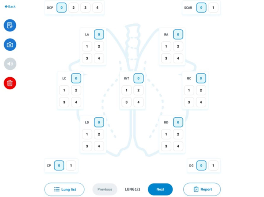 <p>Figure 2 : Logiciel num&eacute;rique utilis&eacute; pour l'&eacute;valuation. Les parties des poumons &eacute;valu&eacute;es sur une &eacute;chelle de points comprenaient le lobe apical gauche, le lobe cardiaque gauche, le lobe diaphragmatique gauche, le lobe moyen, le lobe diaphragmatique droit, le lobe cardiaque droit, le lobe apical droit, ainsi que les zones affect&eacute;es par la pleur&eacute;sie cr&acirc;niale, la pleur&eacute;sie dorso-caudale et la pr&eacute;sence de cicatrices.</p>
