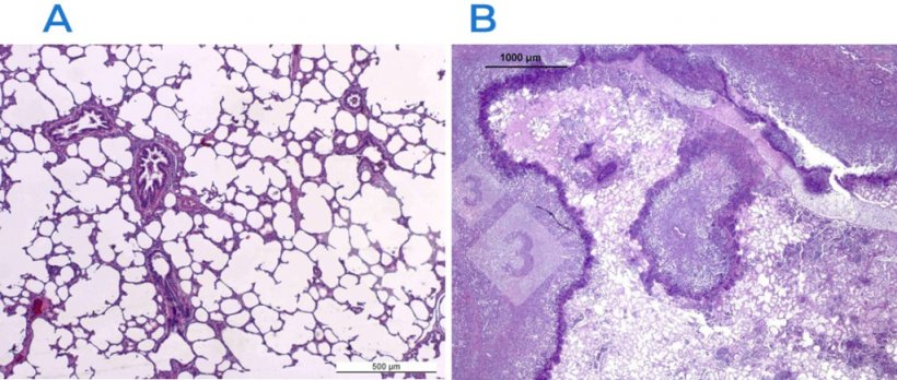 Figure 2 : Coloration &agrave; l&#39;h&eacute;matoxyline-&eacute;osine d&#39;un poumon normal (A) et d&#39;un poumon atteint (B). Le poumon en B est atteint d&#39;une pleuropneumonie fibrino-n&eacute;crotique caus&eacute;e par Actinobacillus pleuropneumoniae.
