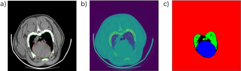 Figure 6. Images de TC o&ugrave; le volume et le profil cardiaques sont identifi&eacute;s (a, b) et o&ugrave; les diff&eacute;rents types de tissus sont automatiquement diff&eacute;renci&eacute;s (c).
