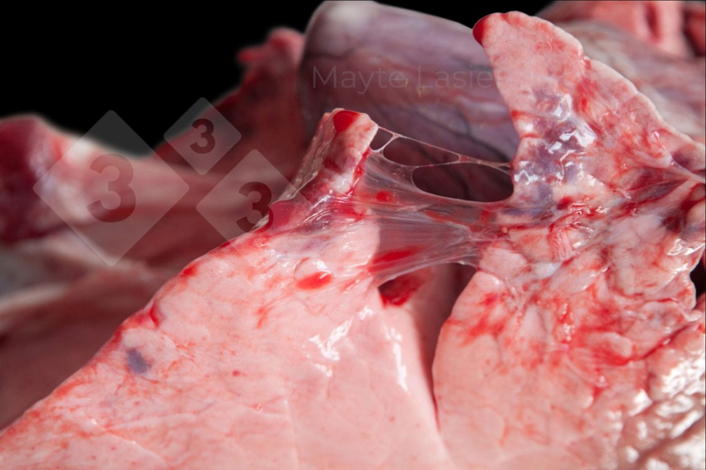 <p>Pleurésie crâniale</p>