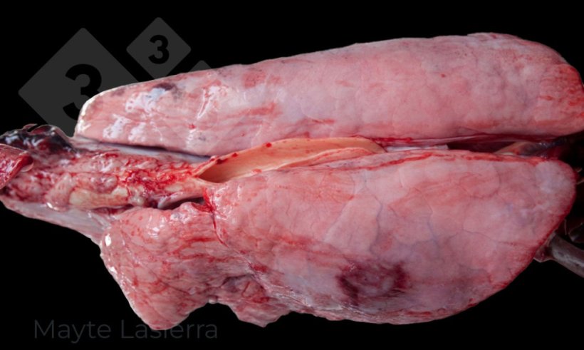 Pleurésie dorsocaudale