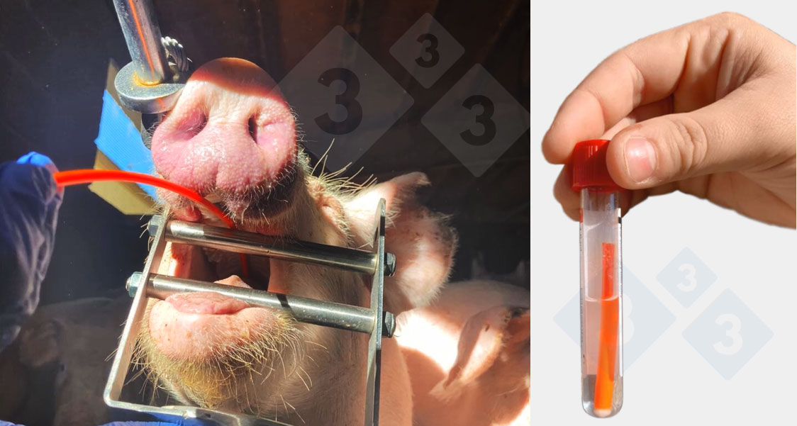 <p>Pr&eacute;l&egrave;vement d'&eacute;chantillons par raclage trach&eacute;obronchique</p>
