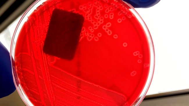 Rycina 1. Czysta hodowla hemolitycznej bakterii E. coli na płytce agarowej z krwią. Zwr&oacute;ć uwagę na czystą strefę wok&oacute;ł każdej kolonii bakteryjnej, wskazującą na hemolizę (rozkład krwi w agarze płytkowym). Zdjęcia: Iowa State University, Weterynaryjne Laboratorium Diagnostyczne, Sekcja Bakteriologii
