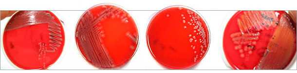 Morfologia różnych kolonii patogennych izolatów E.coli 