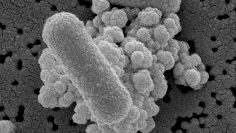 Clostridium perfringens
